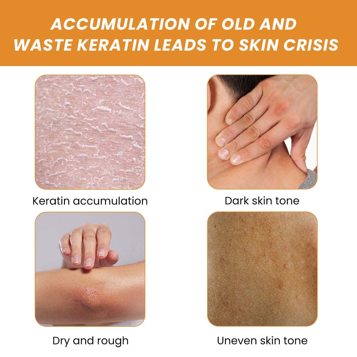 Orange Enzyme Exfoliating – Brightening & Blackhead Remover